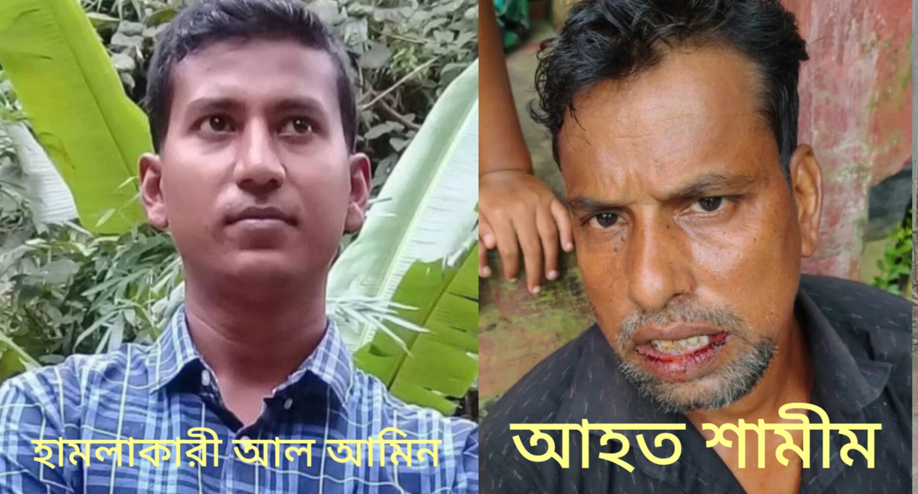 কসবায় বসতবাড়িতে হামলা, যুবককে হত্যাচেষ্টার অভিযোগ; নারীর স্বর্ণের চেইন ছিনতাই!